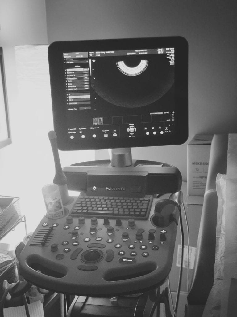 Ultrasound at the IVF doctor