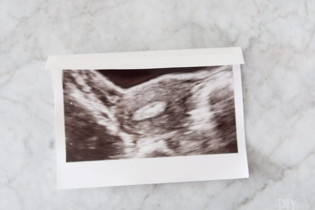 IVF embryo transfer