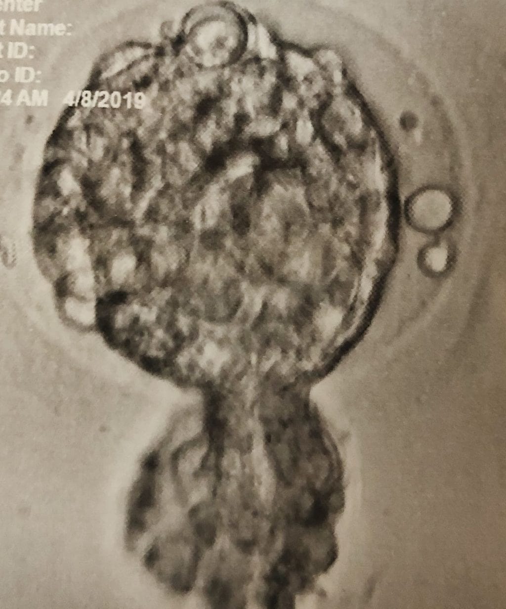 our embryo