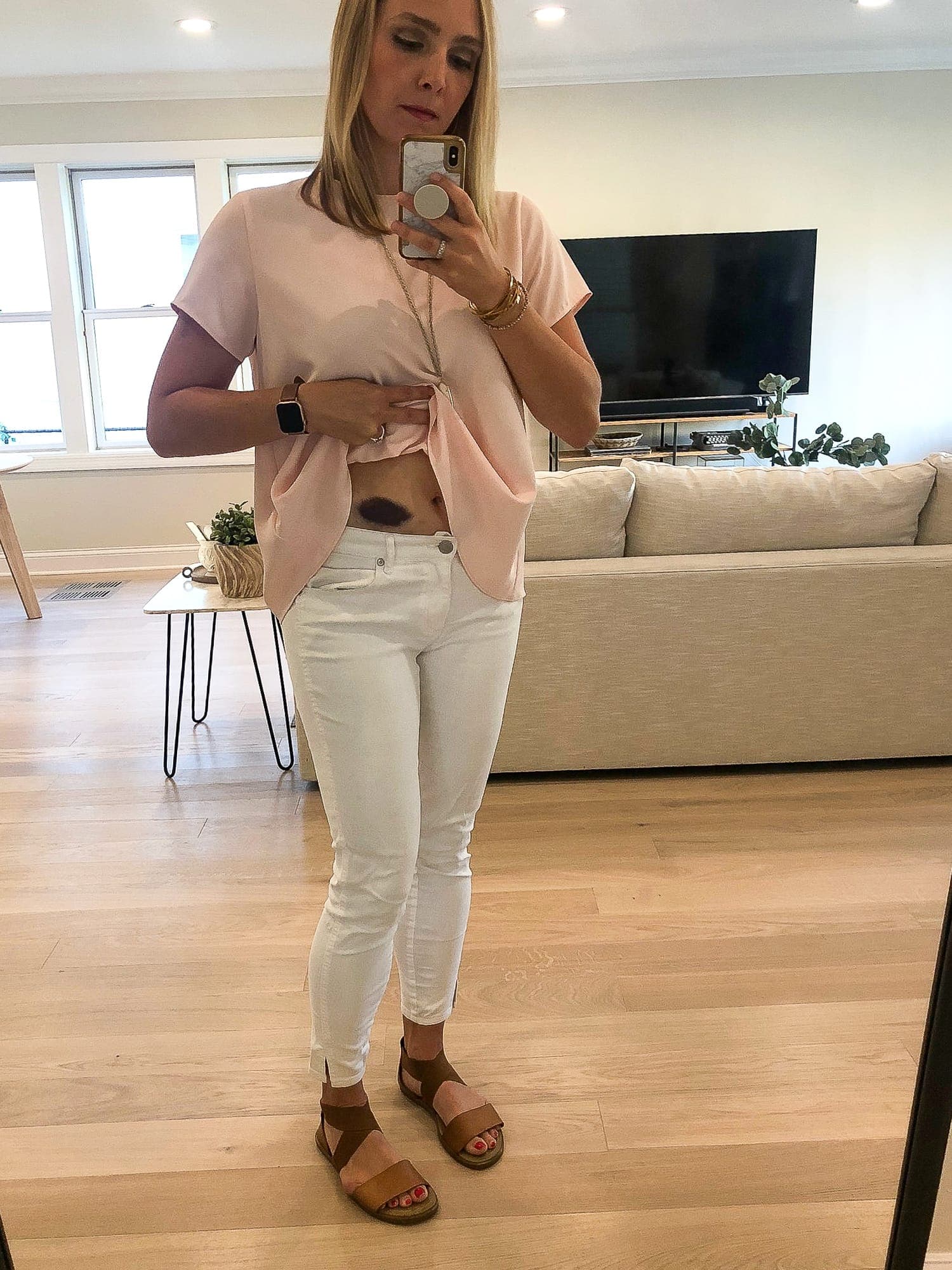 Lovenox shot bruises
